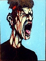 HeadInjury7