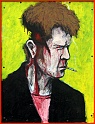 HeadInjury_9